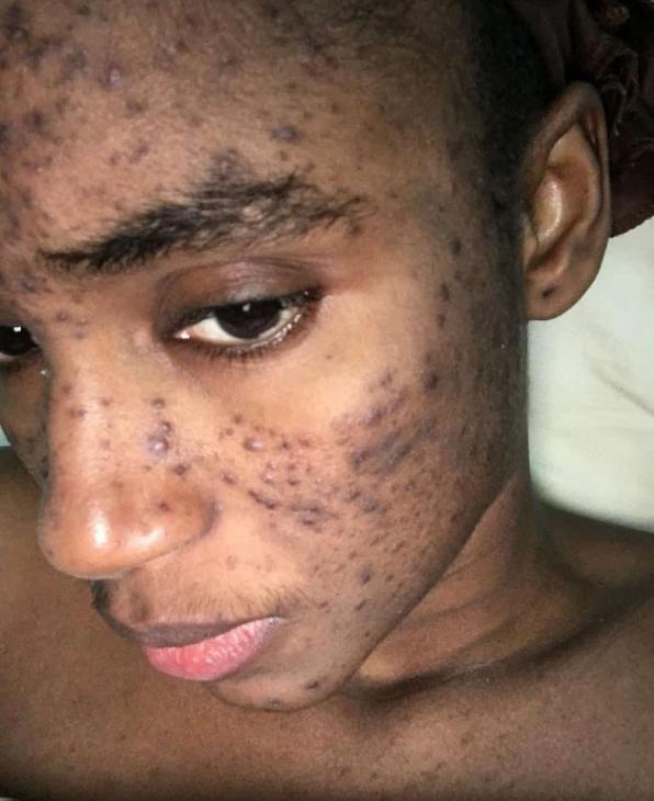 Mariama Diallo une marque de beauté aurait ruiné sa carrière