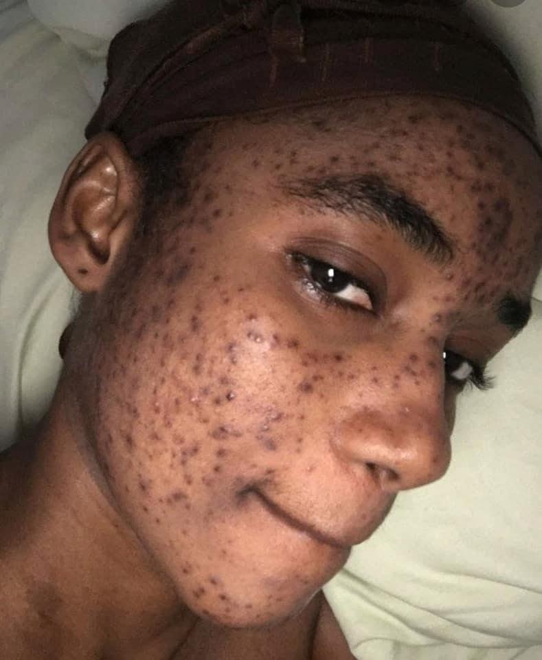 Mariama Diallo une marque de beauté aurait ruiné sa carrière